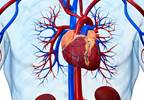 Kidney Stones and CVD Linked by Calcium Deposits Kidney Stones and CVD Linked by Calcium Deposits