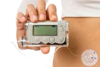 Researchers say regulators should require more from insulin pump manufacturing companies and gather more data on long-term use. Researchers say regulators should require more from insulin pump manufacturing companies and gather more data on long-term use.