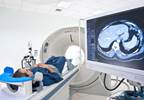 Adverse Prostate Cancer Pathology Accurately Predicted With MRI Adverse Prostate Cancer Pathology Accurately Predicted With MRI