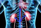 Paying Donors May Encourage Kidney Donation Paying Donors May Encourage Kidney Donation