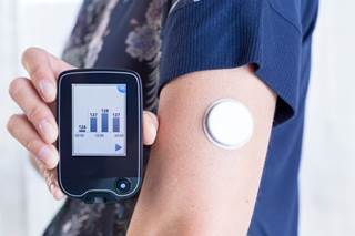 CGM glucose values increased versus blood glucose meter values in acetaminophen challenge. CGM glucose values increased versus blood glucose meter values in acetaminophen challenge.