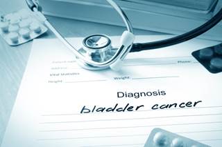The syndrome is associated with a significant 2-fold increased risk of urothelial carcinoma of the bladder. The syndrome is associated with a significant 2-fold increased risk of urothelial carcinoma of the bladder.
