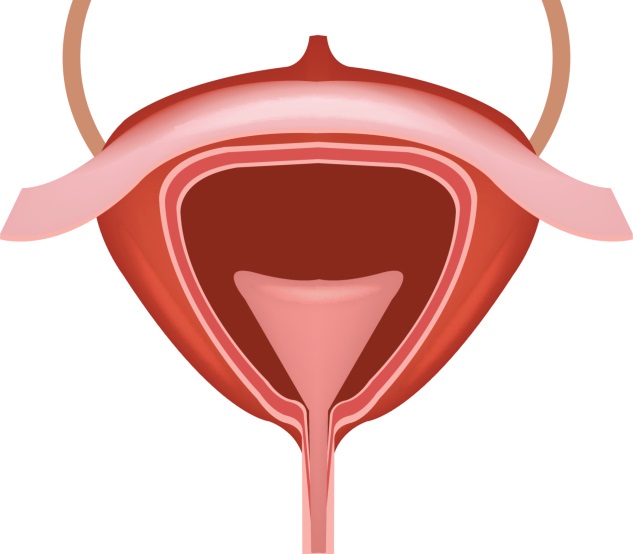 Tert Test May Improve Detection Of Bladder Cancer