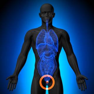Oncologic outcomes are similar for focal and total cryoablation for localized prostate cancer, but patients report significantly better sexual function after focal cryoablation. Oncologic outcomes are similar for focal and total cryoablation for localized prostate cancer, but patients report significantly better sexual function after focal cryoablation.