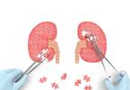 Personalized Tx May Extend Life in CKD With Small Renal Tumors Personalized Tx May Extend Life in CKD With Small Renal Tumors