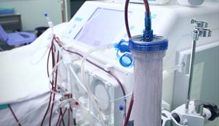 Non-adherence to hemodialysis schedules is most notable at a temperature above 82.4° F and precipitation levels above 8 inches per 24 hours. Non-adherence to hemodialysis schedules is most notable at a temperature above 82.4° F and precipitation levels above 8 inches per 24 hours.
