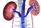 Copeptin Predicts IgA Nephropathy Outcomes Copeptin Predicts IgA Nephropathy Outcomes