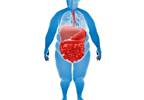 Donor, Recipient Factors Influence Kidney Transplant Costs Donor, Recipient Factors Influence Kidney Transplant Costs