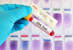 Single PSA Screening Has No Effect on Prostate Cancer Mortality Single PSA Screening Has No Effect on Prostate Cancer Mortality