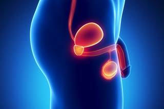 Study compared PCa patients who underwent surgery or radiation treatment with a matched group of non-cancer controls. Study compared PCa patients who underwent surgery or radiation treatment with a matched group of non-cancer controls.
