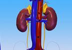Metabolites Linked to Faster Renal Decline, Failure in Type 1 Diabetes Metabolites Linked to Faster Renal Decline, Failure in Type 1 Diabetes