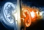 ESRD Risk Factors in IgAN Patients Identified ESRD Risk Factors in IgAN Patients Identified
