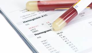 At 24 weeks, greater HbA1c reductions were seen with combination empagliflozin + metformin therapy. At 24 weeks, greater HbA1c reductions were seen with combination empagliflozin + metformin therapy.