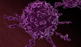 Prevalence of obesity is high in adults with a history of breast, prostate, or colorectal cancer. Prevalence of obesity is high in adults with a history of breast, prostate, or colorectal cancer.