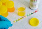 Avoid These 5 Pediatric Nephrology Tests Avoid These 5 Pediatric Nephrology Tests