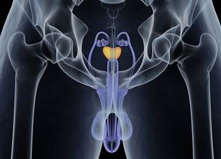 An new editorial offers an explanation why radium-223 used in combination with prednisone and abiraterone did not lower the risk of symptomatic skeletal events in men with mCRPC. An new editorial offers an explanation why radium-223 used in combination with prednisone and abiraterone did not lower the risk of symptomatic skeletal events in men with mCRPC.