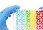 Novel PSA Assay Improves Prostate Cancer Diagnosis Novel PSA Assay Improves Prostate Cancer Diagnosis