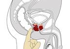 Digital Rectal Examination, PSA Testing Rates Declining Digital Rectal Examination, PSA Testing Rates Declining