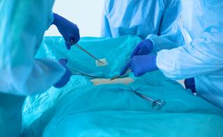 Mortality after elective surgery increases in graded manner as day of surgery approaches weekend. Mortality after elective surgery increases in graded manner as day of surgery approaches weekend.