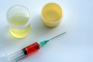 Levels of 10 mg/dL or higher and below 6 mg/dL predicted approximately 50% higher death risk in the 3 months after dialysis initiation. Levels of 10 mg/dL or higher and below 6 mg/dL predicted approximately 50% higher death risk in the 3 months after dialysis initiation.