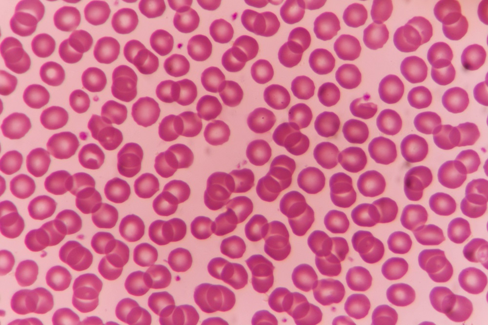 Artificial Red Blood Cell Created - Renal and Urology News