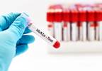 Prediabetes Diagnosed by A1c Tied With Excess Risks Prediabetes Diagnosed by A1c Tied With Excess Risks