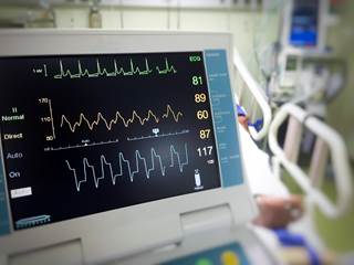 Adjusted rates of hospitalization for AF increased by almost 1% per year between 1999 and 2013. Adjusted rates of hospitalization for AF increased by almost 1% per year between 1999 and 2013.