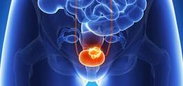 Instilling mitomycin C within 24 hours of TURBT vs after 2 weeks was associated with a 27% lower risk of recurrence. Instilling mitomycin C within 24 hours of TURBT vs after 2 weeks was associated with a 27% lower risk of recurrence.