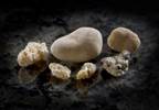 Kidney Stone Diagnoses Up From 1984 to 2012 Kidney Stone Diagnoses Up From 1984 to 2012