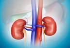 Living Kidney Donor Graft Survival Improving Living Kidney Donor Graft Survival Improving