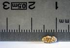 Tamsulosin Improves Clearance of Large Distal Ureteral Stones Tamsulosin Improves Clearance of Large Distal Ureteral Stones