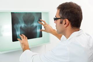 aBSI validated as prognostic biomarker of survival in metastatic castration-resistant prostate cancer aBSI validated as prognostic biomarker of survival in metastatic castration-resistant prostate cancer