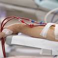 Longer Dialysis Time and Patient Suffering Longer Dialysis Time and Patient Suffering