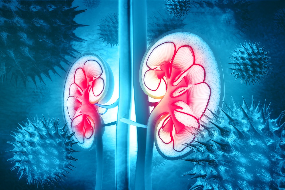 Inflammatory Marker Tied To Decline In Kidney Function - Renal And ...