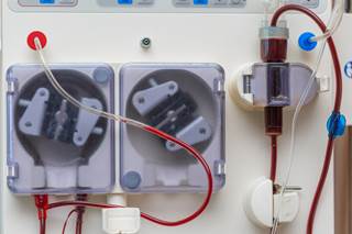 More than half of patients died prematurely, regardless of whether they received early or delayed RRT. More than half of patients died prematurely, regardless of whether they received early or delayed RRT.
