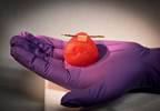 3D Printing Surgical Models for Kidney Cancer Care 3D Printing Surgical Models for Kidney Cancer Care