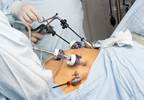 Kidney Disease Risk May Be Reduced With Bariatric Surgery Kidney Disease Risk May Be Reduced With Bariatric Surgery