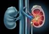 Dusting vs Basketing During Ureteroscopy Dusting vs Basketing During Ureteroscopy