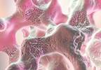 Parathyroidectomy Found to Up Bone Density in SHPT Parathyroidectomy Found to Up Bone Density in SHPT