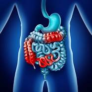 Inflammatory bowel disease is associated with a nearly 5-fold increased risk of prostate cancer, study finds. Inflammatory bowel disease is associated with a nearly 5-fold increased risk of prostate cancer, study finds.